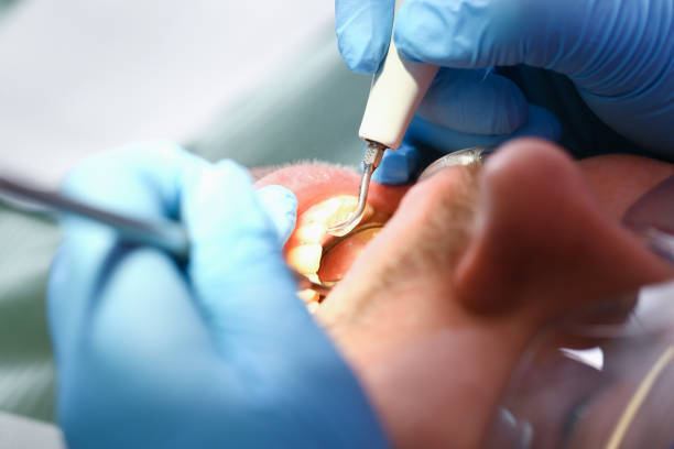 Best Emergency Dental Care for Sports Injuries in Kingston, OK