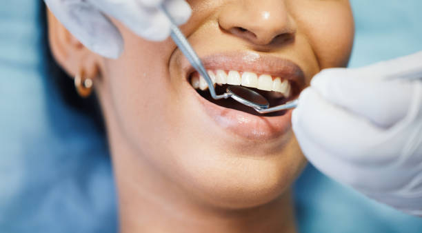 Best Emergency Cosmetic Dentistry (e.g., broken veneers) in Kingston, OK