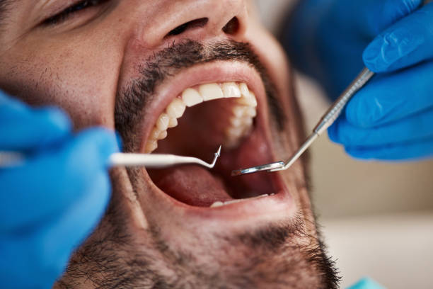 Best 24-Hour Emergency Dental Care in Kingston, OK