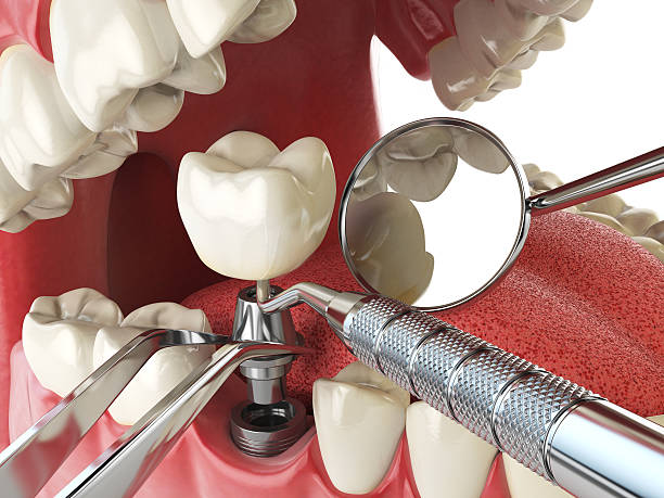 Best Walk-In Emergency Dental Services in Kingston, OK